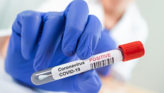 2605 са новите случаи на заразени с коронавирус това са